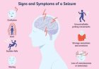 Essential Strategies for Treating Partial Seizures