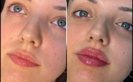 Why Choose Best Plastic Surgeons in Dubai for Non-Surgical Facial Rejuvenation