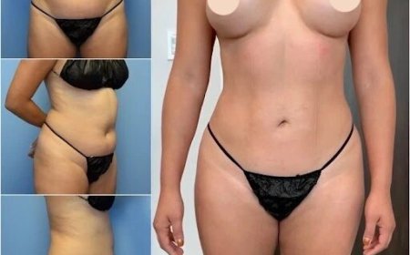 Choosing the Best Body Contouring Surgeon in Dubai for Stunning Results