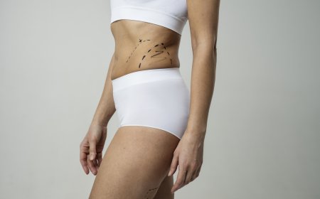 Liposuction Care Plan Approved Tips from Best Liposuction Surgeons in Dubai