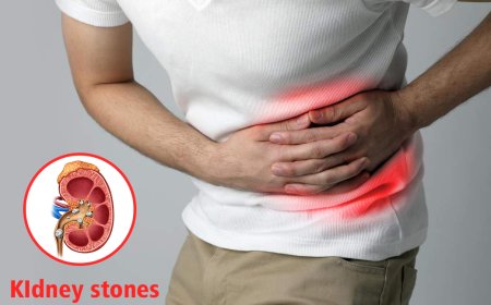 Types of Kidney Stones and Their Treatment Options Explained by Jaipur Experts
