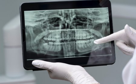 Digital Dental Radiography vs Traditional X-Rays: What’s the Difference?