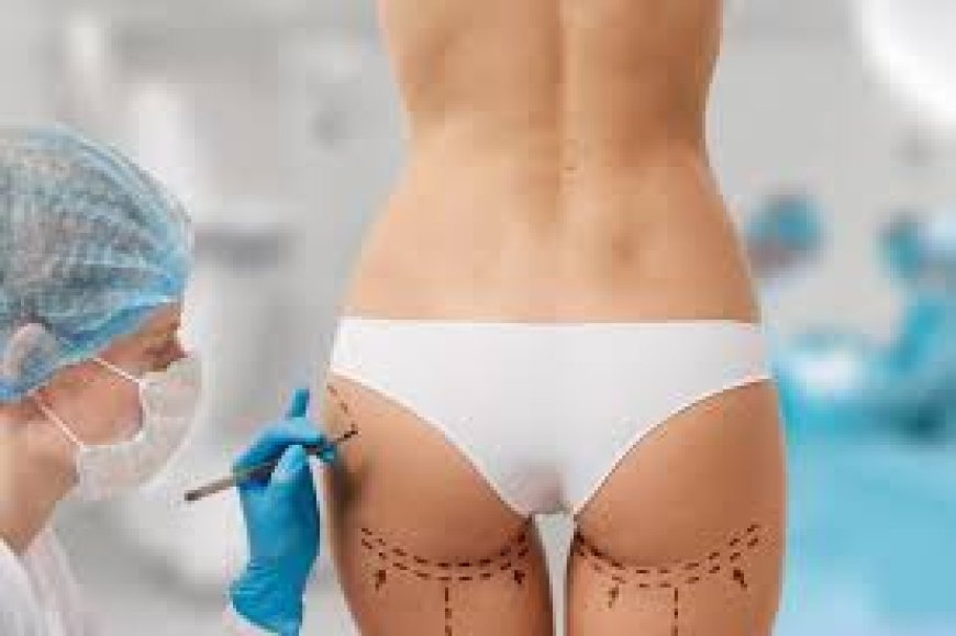 Personalized Treatment Plans: The Approach of the Best Butt Fat Transfer Surgeons in Dubai