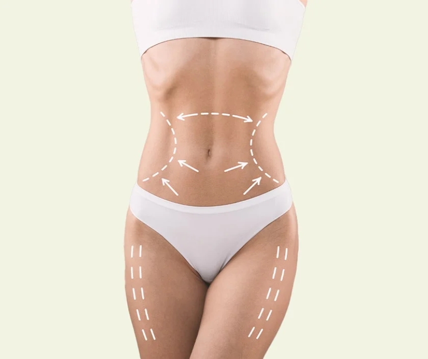 Liposuction in Dubai: How It Can Transform Your Body Contours