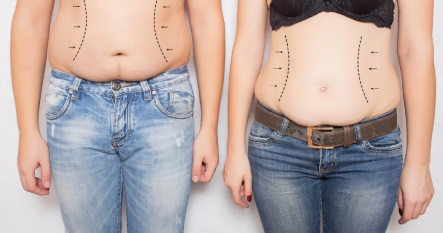 How Obesity Treatment in Dubai Is Helping People Achieve Long-Term Weight Loss